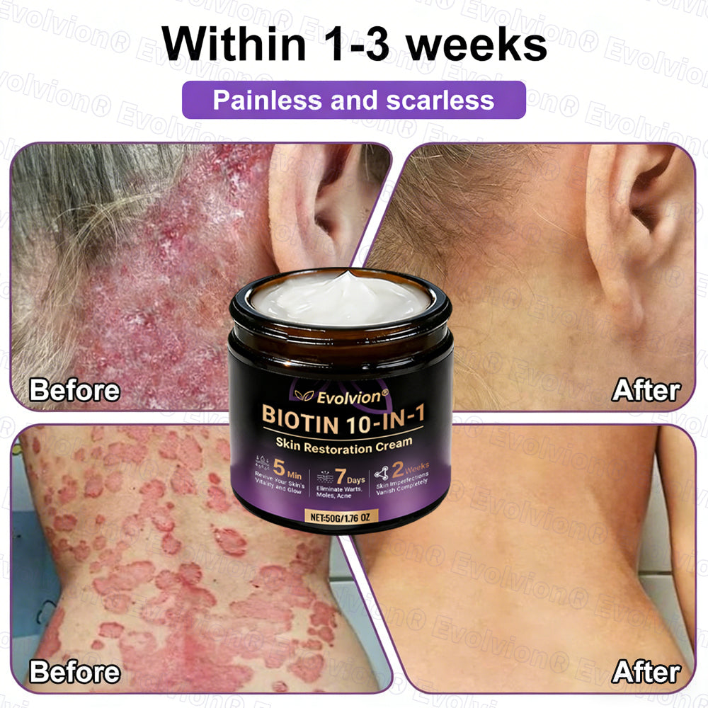 Made and Shipped from USA ✨Evolvion® Biotin 10-in-1 Skin Restoration Cream