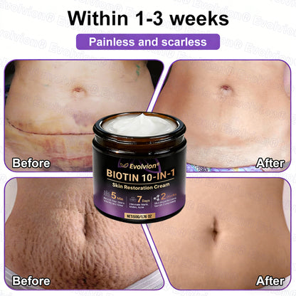 Made and Shipped from USA ✨Evolvion® Biotin 10-in-1 Skin Restoration Cream