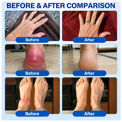 🦵 GFOUK® ArthriCare — Diclofenac Advanced Joint Comfort & Mobility Cream 🌺