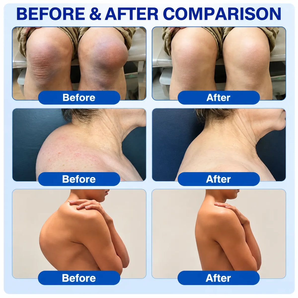 🦵 GFOUK® ArthriCare — Diclofenac Advanced Joint Comfort & Mobility Cream 🌺