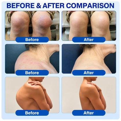 🦵 GFOUK® ArthriCare — Diclofenac Advanced Joint Comfort & Mobility Cream 🌺
