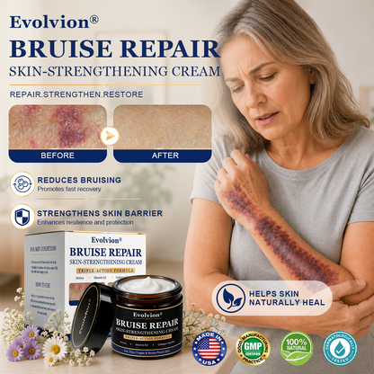✨ Bruise-Prone Skin? Discover Evolvion® Bruise Repair & Skin-Strengthening Cream🍀