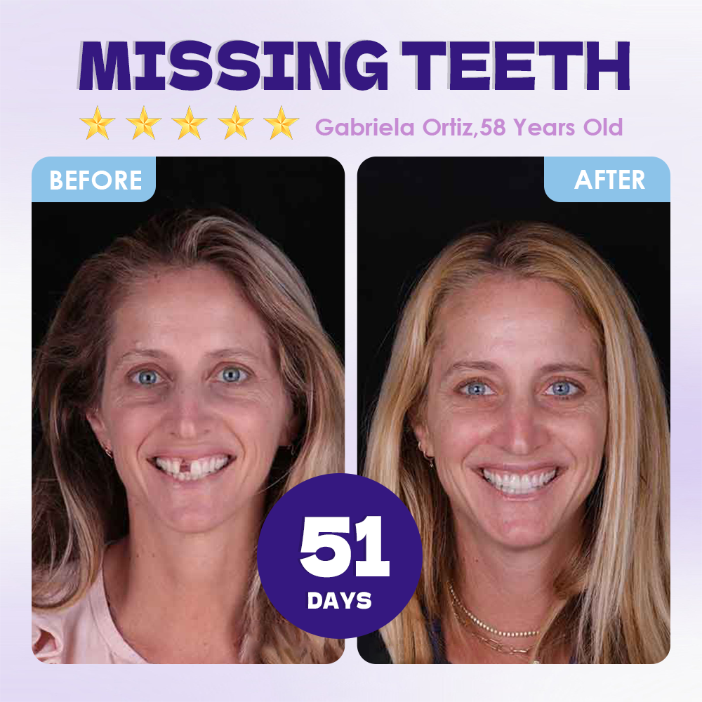 GFOUK® Tideglusib Tooth & Gum Repair Oral Microneedle Patch  | 𝐀𝐝𝐯𝐚𝐧𝐜𝐞𝐝 𝐒𝐭𝐞𝐦-𝐂𝐞𝐥𝐥 𝐀𝐜𝐭𝐢𝐯𝐚𝐭𝐢𝐨𝐧 𝐓𝐞𝐞𝐭𝐡 𝐒𝐭𝐫𝐢𝐩𝐬(🦷𝐑𝐞𝐛𝐮𝐢𝐥𝐝 𝐄𝐧𝐚𝐦𝐞𝐥 & 𝐃𝐞𝐧𝐭𝐢𝐧 • 𝐒𝐭𝐫𝐞𝐧𝐠𝐭𝐡𝐞𝐧 𝐆𝐮𝐦𝐬 • 𝐄𝐫𝐚𝐝𝐢𝐜𝐚𝐭𝐞 𝐓𝐚𝐫𝐭𝐚𝐫 & 𝐎𝐝𝐨𝐫 • 𝐒𝐭𝐨𝐩 𝐓𝐨𝐨𝐭𝐡 𝐒𝐞𝐧𝐬𝐢𝐭𝐢𝐯𝐢𝐭𝐲)