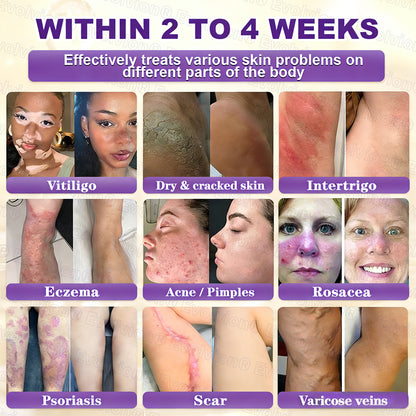 Made and Shipped from USA ✨Evolvion® Biotin 10-in-1 Skin Restoration Cream