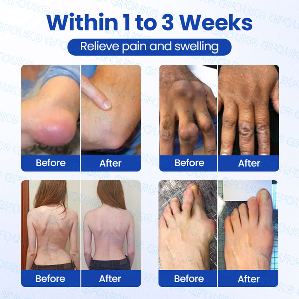 𝐎𝐟𝐟𝐢𝐜𝐢𝐚𝐥 𝐒𝐭𝐨𝐫𝐞 🇺🇸 | GFOUK® BPC-157 × NSAID 10-in-1 Penetrating Greaseless Arthritis Gel 🍀