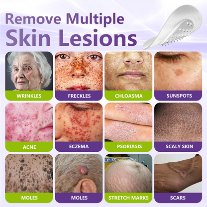 Made and Shipped from USA ✨GFOUK® Soluble Microneedle Botanical Skin Tag Removal Patch🍇
