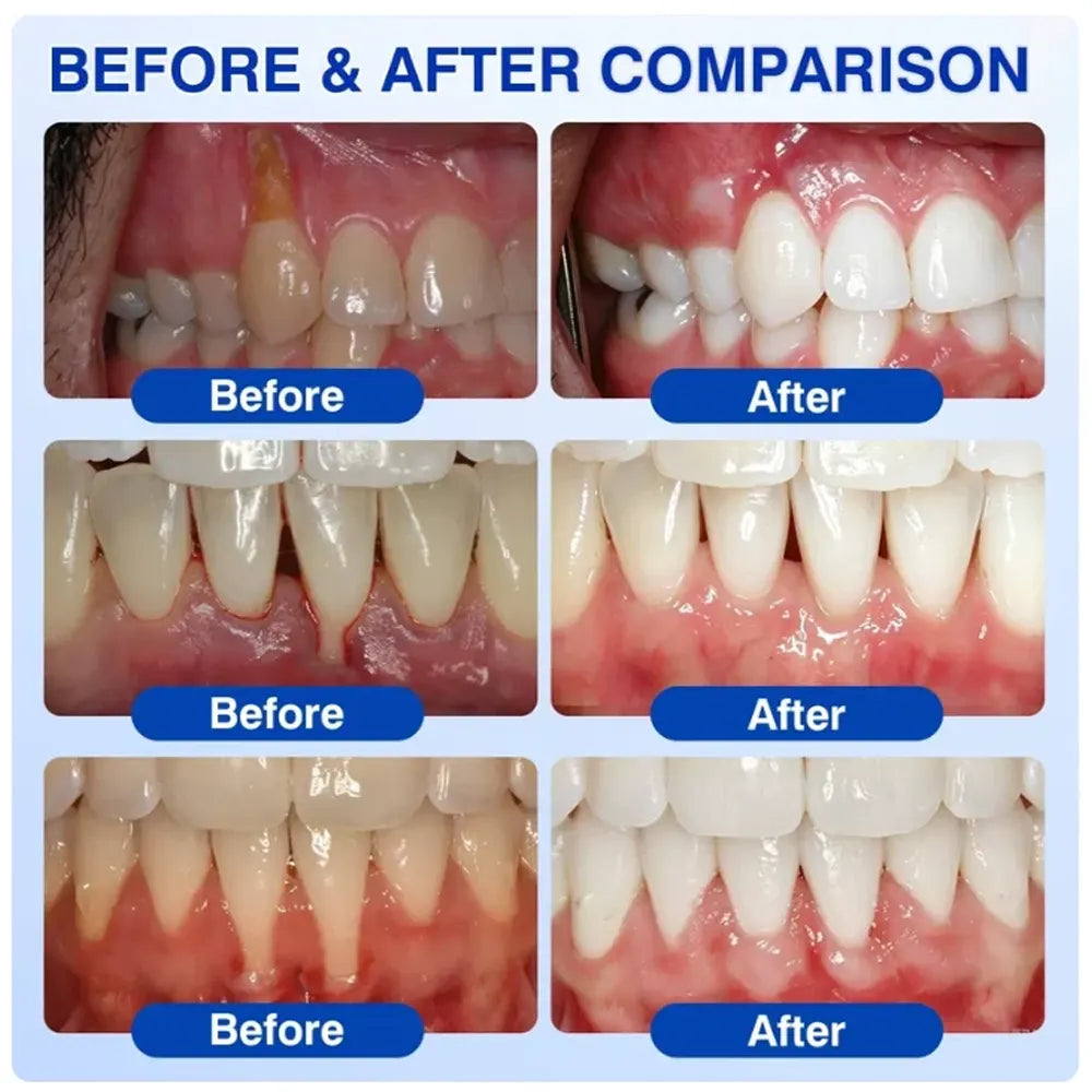 Pheromex® 🦷GumRevive Periodontal Care Gel 🌼