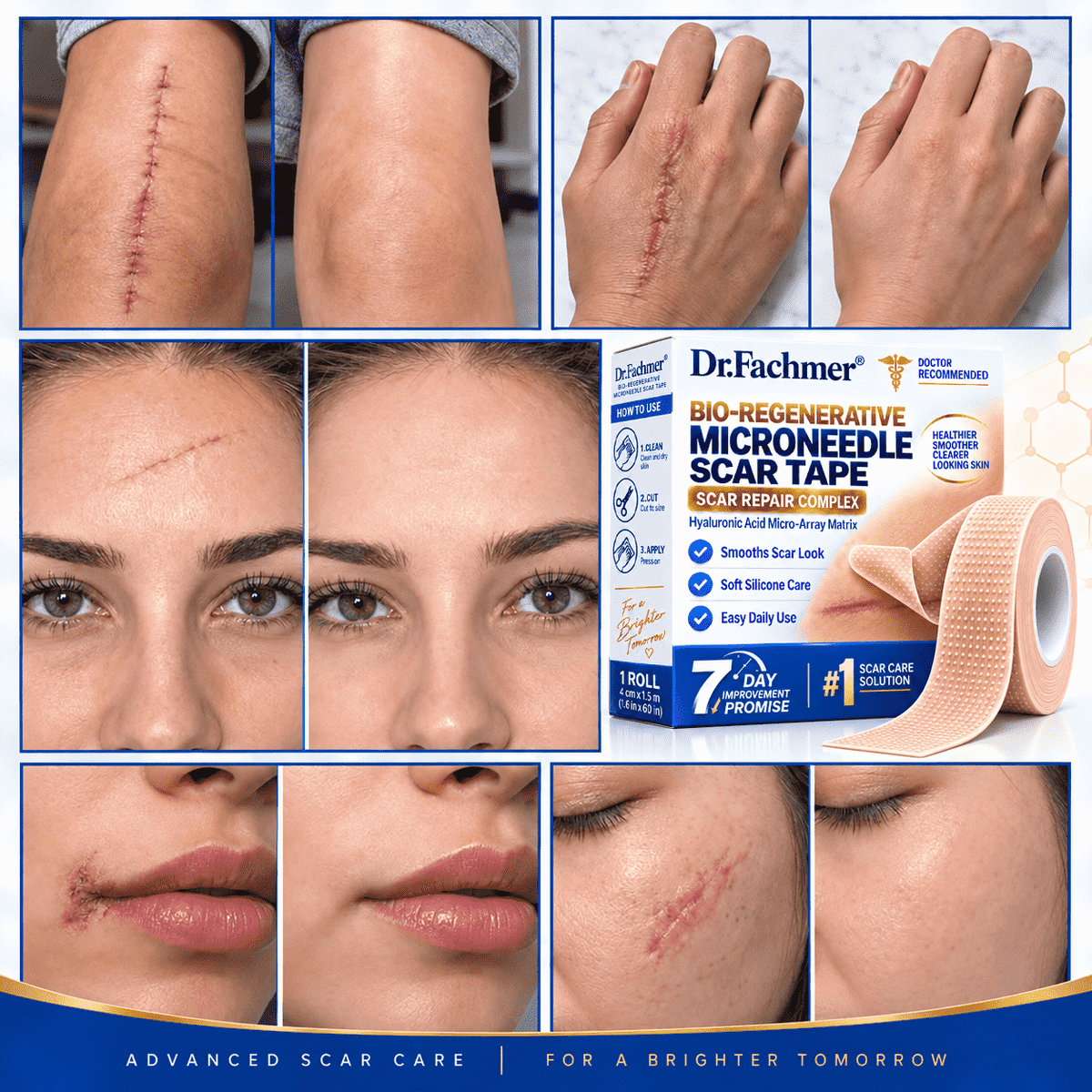 Dr.Fachmer® Bio-Regenerative Microneedle Scar Tape