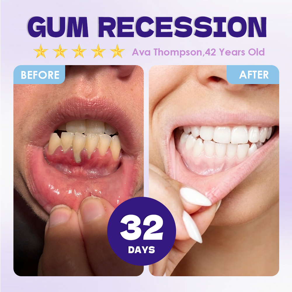GFOUK® Tideglusib Tooth & Gum Repair Oral Microneedle Patch  | 𝐀𝐝𝐯𝐚𝐧𝐜𝐞𝐝 𝐒𝐭𝐞𝐦-𝐂𝐞𝐥𝐥 𝐀𝐜𝐭𝐢𝐯𝐚𝐭𝐢𝐨𝐧 𝐓𝐞𝐞𝐭𝐡 𝐒𝐭𝐫𝐢𝐩𝐬(🦷𝐑𝐞𝐛𝐮𝐢𝐥𝐝 𝐄𝐧𝐚𝐦𝐞𝐥 & 𝐃𝐞𝐧𝐭𝐢𝐧 • 𝐒𝐭𝐫𝐞𝐧𝐠𝐭𝐡𝐞𝐧 𝐆𝐮𝐦𝐬 • 𝐄𝐫𝐚𝐝𝐢𝐜𝐚𝐭𝐞 𝐓𝐚𝐫𝐭𝐚𝐫 & 𝐎𝐝𝐨𝐫 • 𝐒𝐭𝐨𝐩 𝐓𝐨𝐨𝐭𝐡 𝐒𝐞𝐧𝐬𝐢𝐭𝐢𝐯𝐢𝐭𝐲)