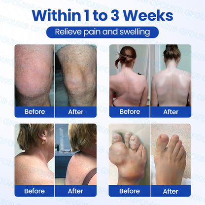 𝐎𝐟𝐟𝐢𝐜𝐢𝐚𝐥 𝐒𝐭𝐨𝐫𝐞 🇺🇸 | GFOUK® BPC-157 × NSAID 10-in-1 Penetrating Greaseless Arthritis Gel 🍀