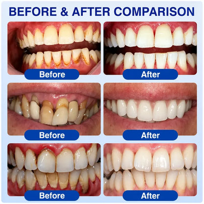 Pheromex® 🦷GumRevive Periodontal Care Gel 🌼