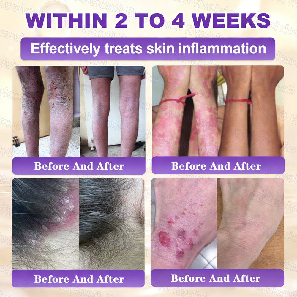 Made and Shipped from USA ✨Evolvion® Biotin 10-in-1 Skin Restoration Cream