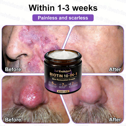 Made and Shipped from USA ✨Evolvion® Biotin 10-in-1 Skin Restoration Cream