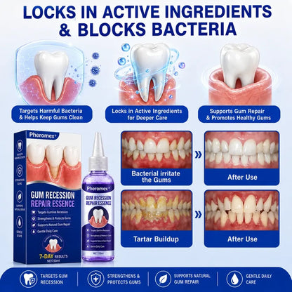 Pheromex® 🦷GumRevive Periodontal Care Gel 🌼