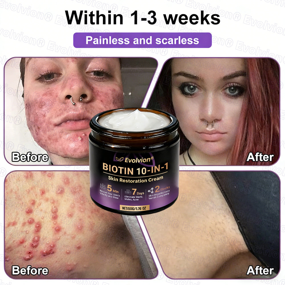 Made and Shipped from USA ✨Evolvion® Biotin 10-in-1 Skin Restoration Cream